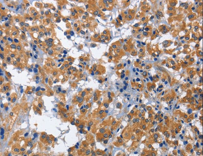 CDK5RAP3 Antibody