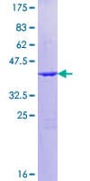 Human BTG2 Protein (Recombinant GST)