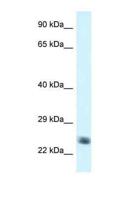 Polyclonal Rabbit anti-Human NDUFS8 Antibody (aa114-163, WB)