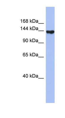 SYNJ2 / Synaptojanin 2 Antibody (aa71-120)