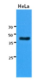 Monoclonal Mouse anti-Human KRT23 / Keratin 23 Antibody (clone AT2F6, WB)