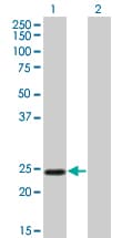 Monoclonal Mouse anti-Human TWIST1 / TWIST Antibody (clone 3E11, WB)