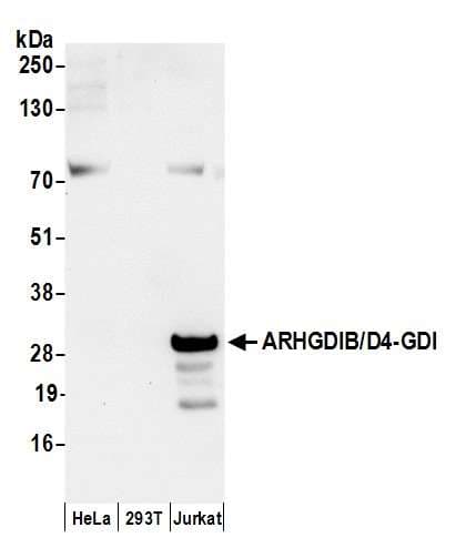Polyclonal Rabbit anti-Human ARHGDIB / D4 GDI Antibody (aa50-100, IHC, WB)