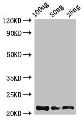 Polyclonal Rabbit anti-Clostridium pasteurianum RD / PHYH Antibody