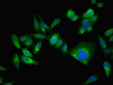IHC-plus™ CA2 / Carbonic Anhydrase II Antibody (aa2-260)