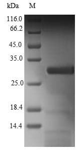 Human C1orf54 Protein (Recombinant 6His-B2M, N-terminus)
