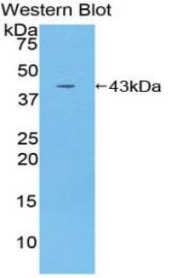IL12RB2 Antibody (aa559-647, PE)