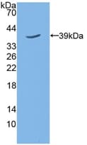 TPBG / 5T4 Antibody (aa34-356)