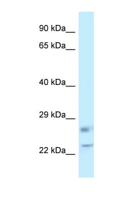 RASL11B Antibody (C-Terminus)