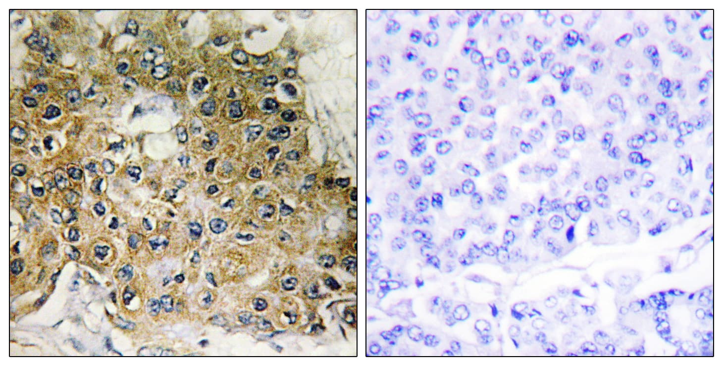 Polyclonal Rabbit anti-Human ITGB1 / Integrin Beta 1 / CD29 Antibody (phospho-Thr789, IHC, IF, WB)