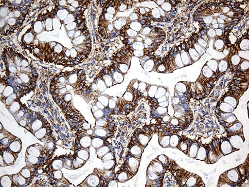 SPTAN1 / Alpha Fodrin Antibody (aa1-147, clone OTI9C10)