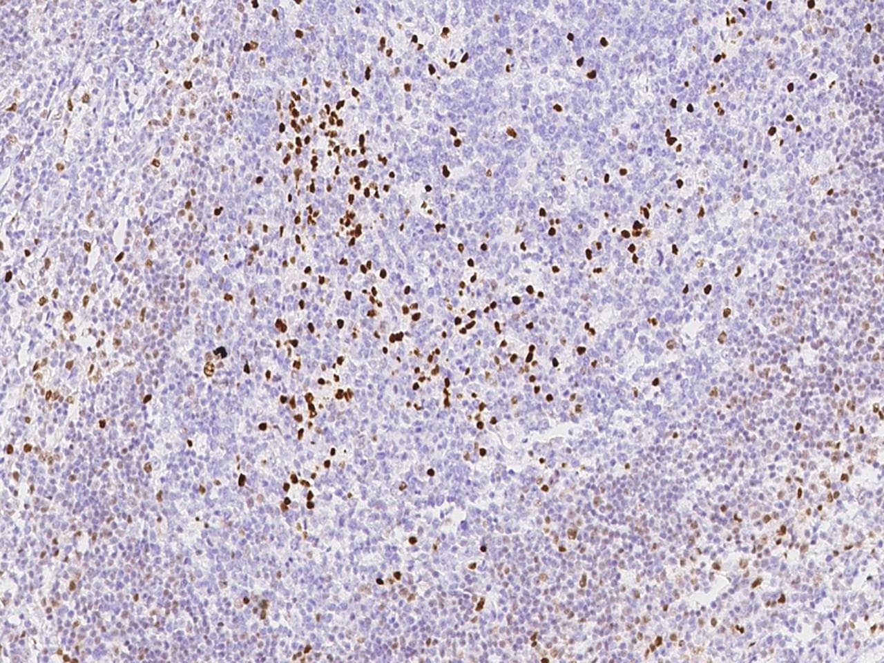 Polyclonal Rabbit anti-Human IRF4 Antibody (IHC)