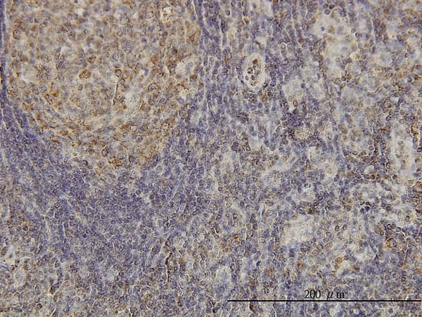 CDKL4 Antibody (clone 6G8)