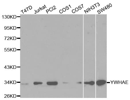 IHC-plus™ YWHAE / 14-3-3 Epsilon Antibody