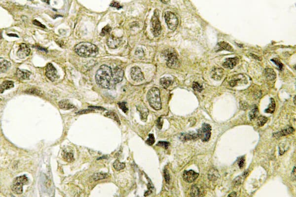 CYP17 / CYP17A1 Antibody (Asn249)