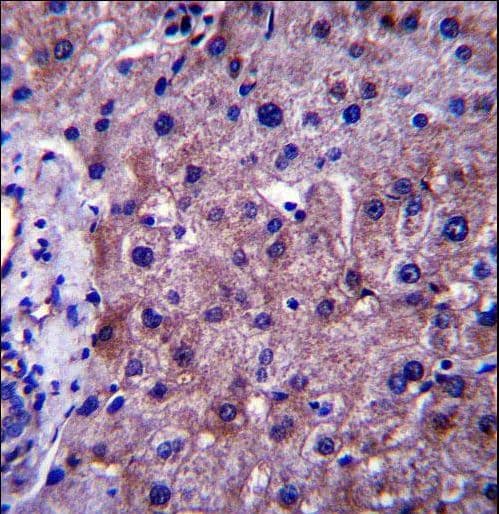 Polyclonal Rabbit anti-Human SGMS1 / TMEM23 Antibody (aa24-53, IHC, WB)