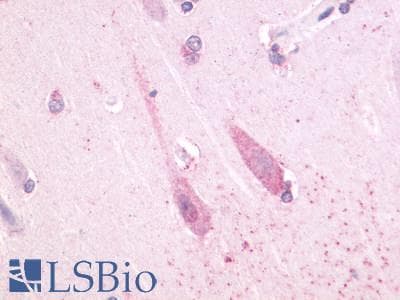 PathPlus™ TAAR1 / TA1 Antibody (Cytoplasmic Domain)