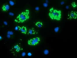 Monoclonal Mouse anti-Human MYD88 Antibody (clone OTI2B2, IHC, IF, WB)