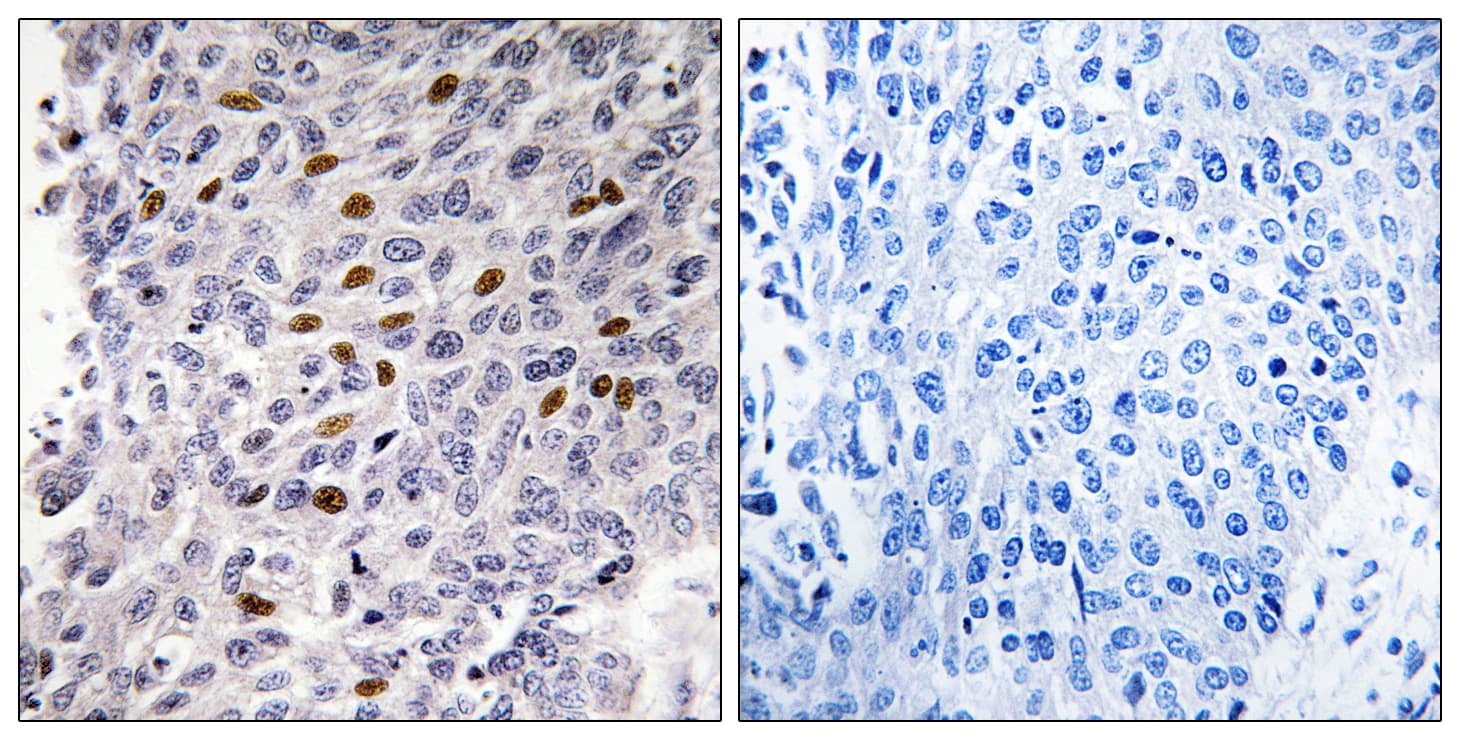 Polyclonal Rabbit anti-Human ATF1 Antibody (aa31-80, IHC, WB)