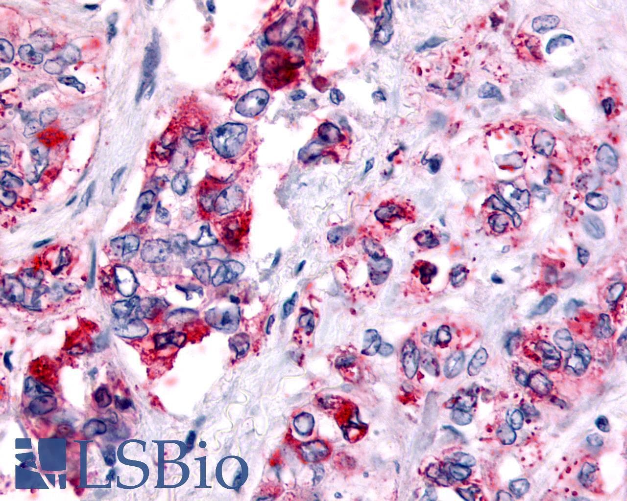 PathPlus™ HRH4 / Histamine H4 Receptor Antibody (Cytoplasmic Domain)