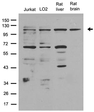 Polyclonal Rabbit anti-Human SELP / P-Selectin / CD62P Antibody (WB)