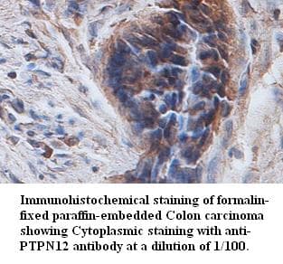 PTP-PEST / PTPN12 Antibody