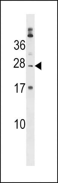 PABPC1L2A Antibody (aa172-200)