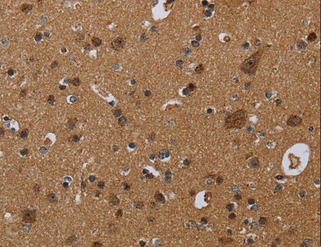 NDUFS8 Antibody