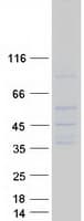 Human SLC14A1 / JK Protein (Recombinant Myc-DDK (Flag))