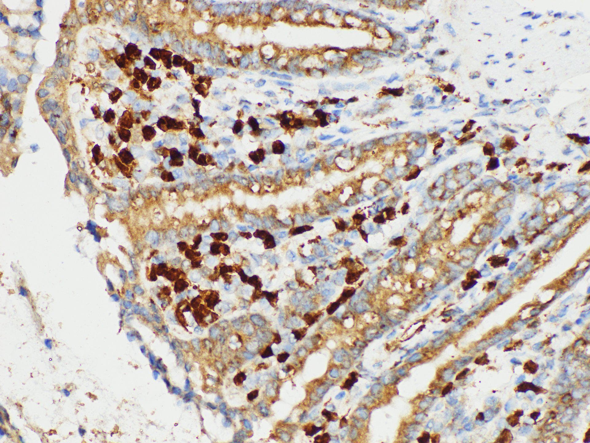 S100A4 / FSP1 Antibody
