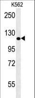 POTEE Antibody (aa380-409)