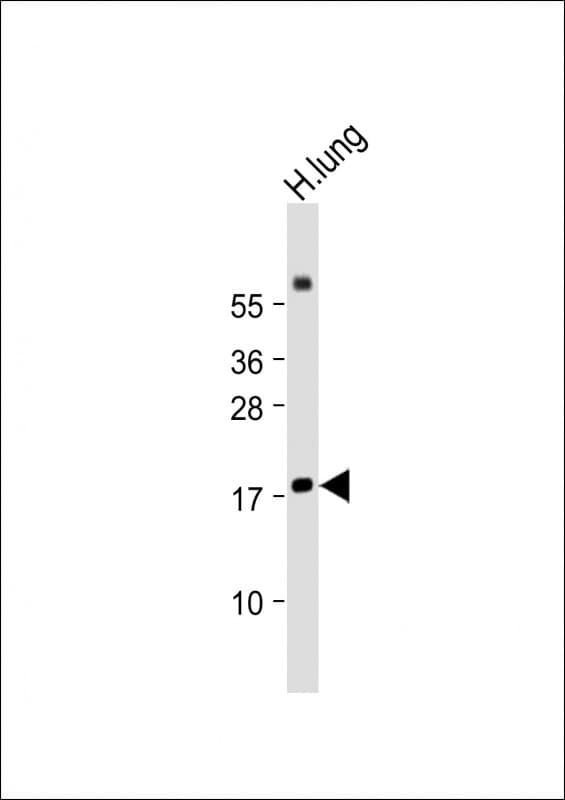RARRES2 / Chemerin Antibody (Internal)