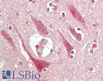 IHC-plus™ Polyclonal Rabbit anti-Human POLR3G Antibody (Internal, IHC, WB)