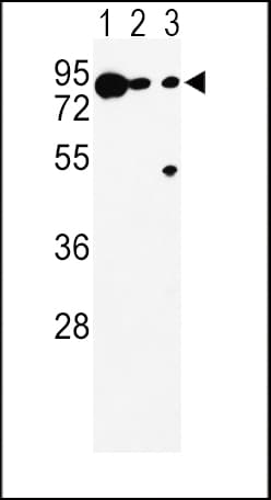 DCT / Dopachrome Tautomerase Antibody (aa62-89)