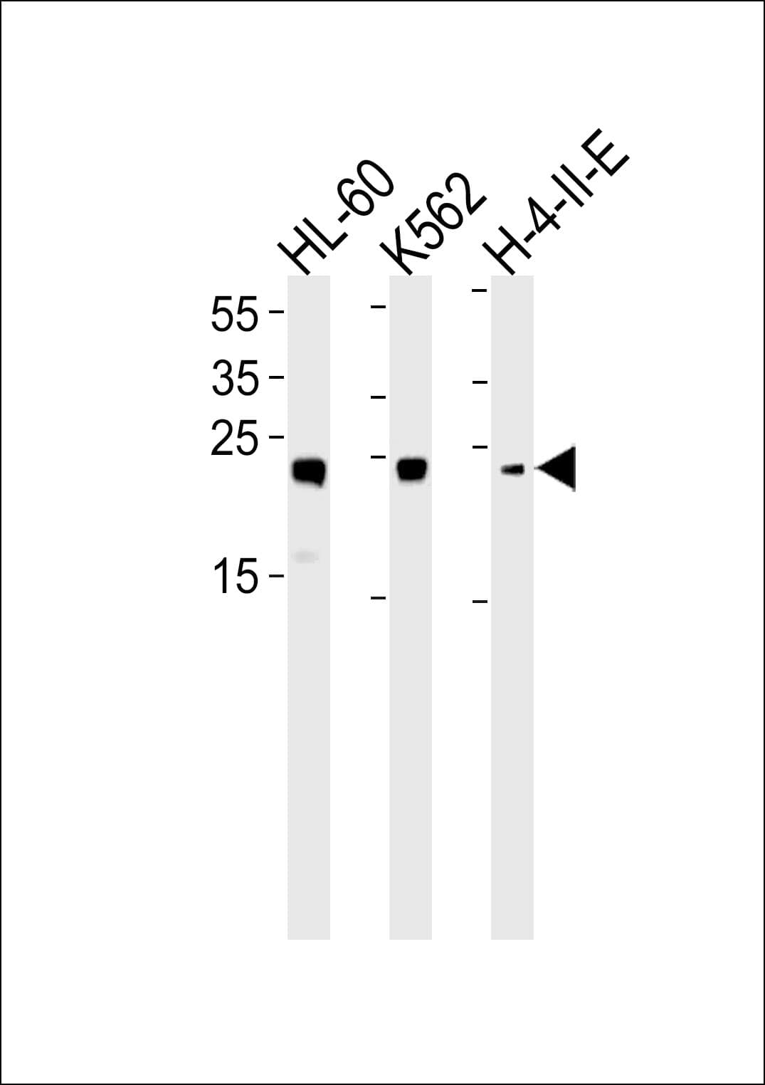 HMG2 / HMGB2 Antibody (aa92-118)