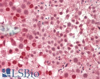IHC-plus™ NCOA2 / TIF2 Antibody (aa1400-C-term)