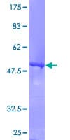 Human RAB5B Protein (Recombinant GST)