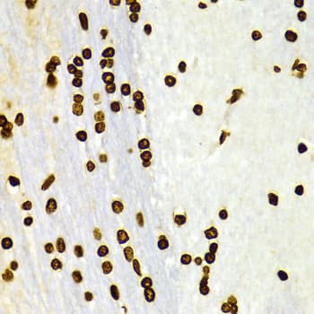 Histone H3 Antibody (Dimethyl-Lys27)
