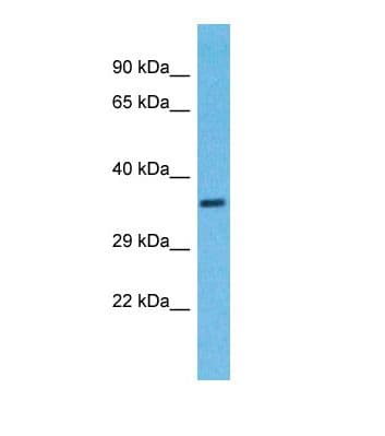 TRIM16 Antibody (aa437-486)