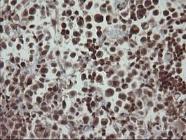 FAM164A / CGI-62 Antibody (clone OTI4B5)