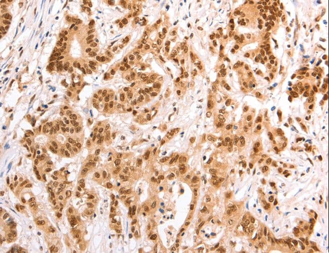Polyclonal Rabbit anti-Human TAX1BP1 Antibody (IHC)