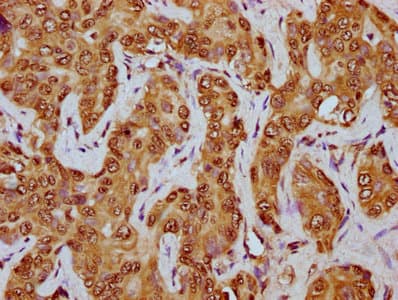 HIST1H2BN Antibody