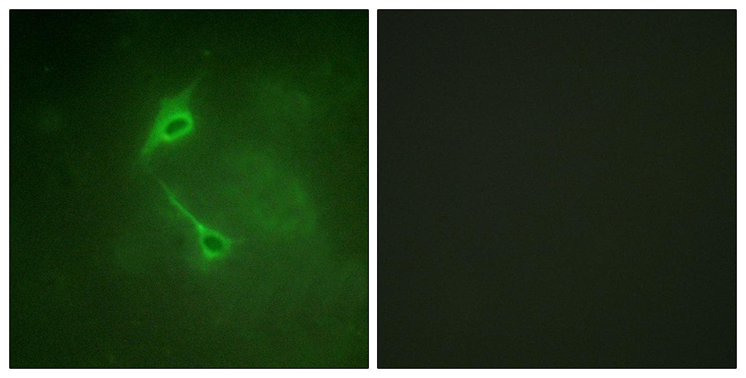 Polyclonal Rabbit anti-Human PRKCZ / PKC-Zeta Antibody (p560, IHC, IF, WB)