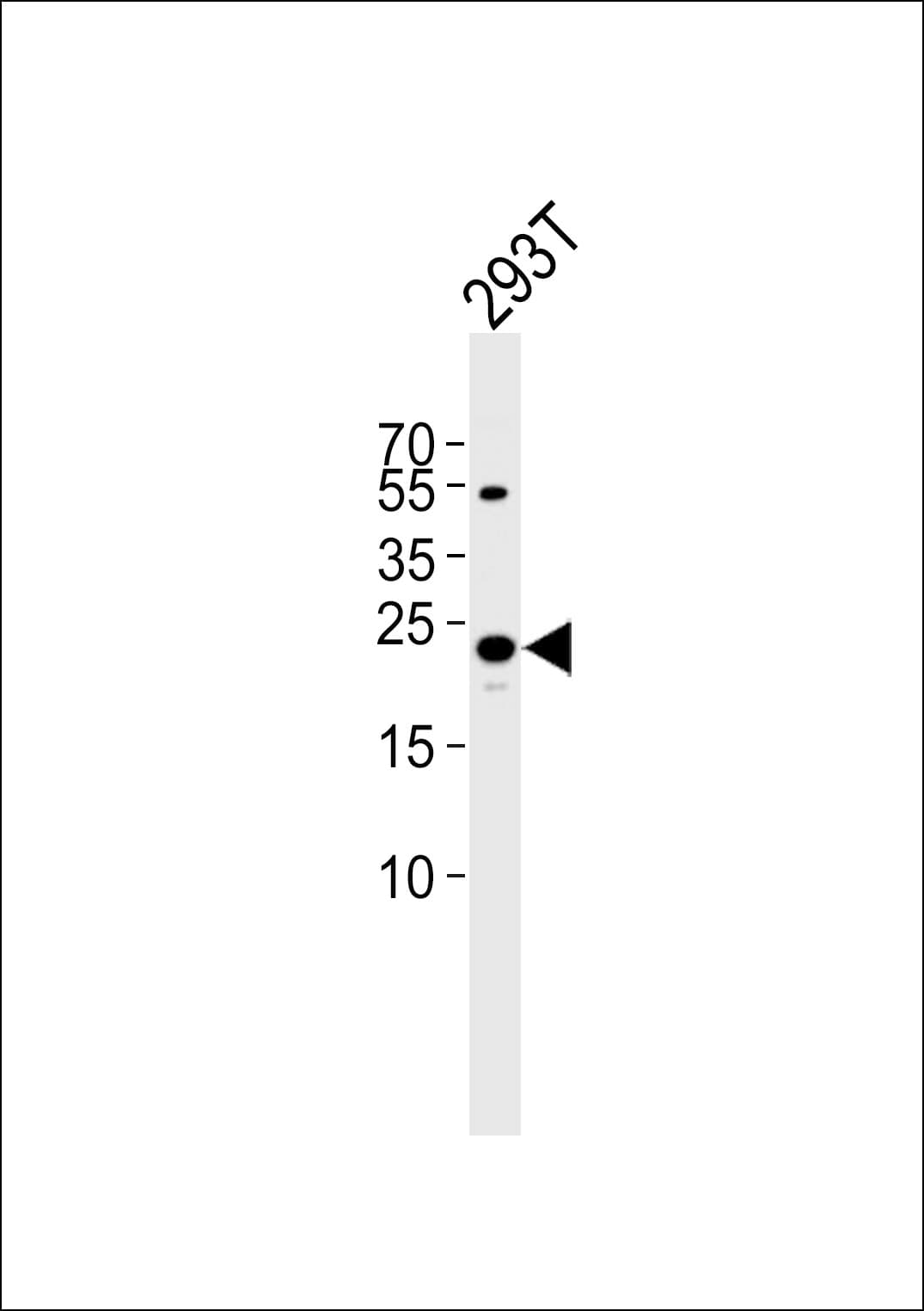 MtTFA / TFAM Antibody (aa216-246)