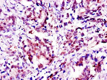 Aprataxin / APTX Antibody