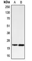 BBC3 / PUMA Antibody (C-Terminus)