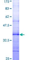 Human SLC9A1 / NHE1 Protein (Recombinant GST, N-terminus)
