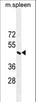 CSA / ERCC8 Antibody (aa210-238)
