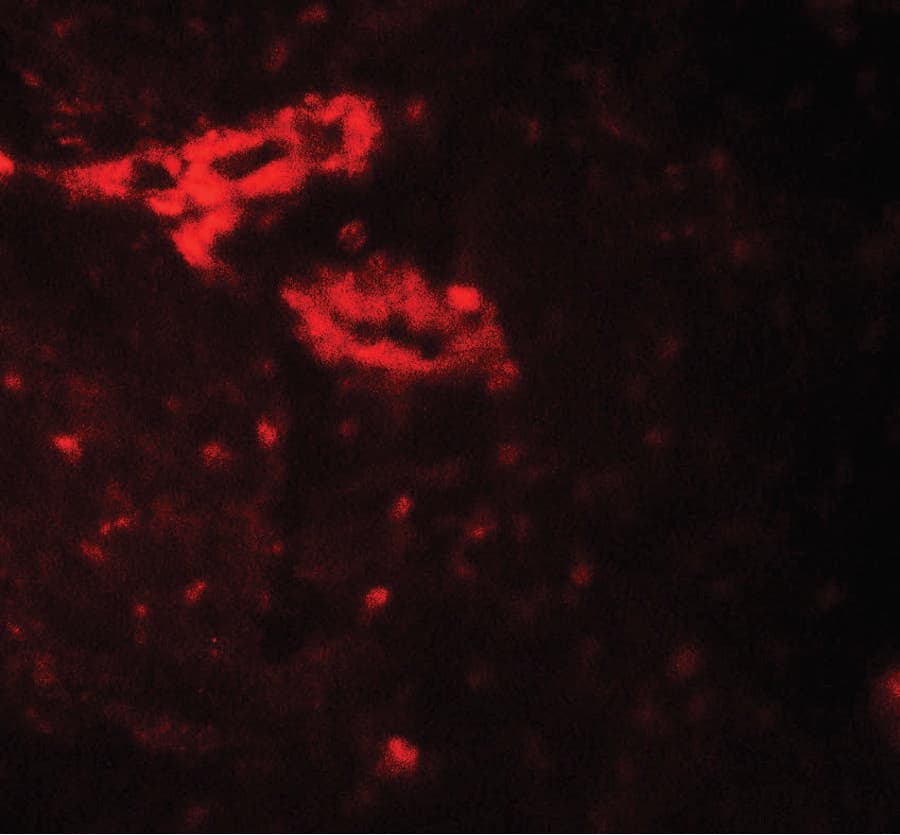 IL1F9 Antibody