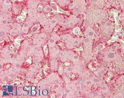 IHC-plus™ PDZK1 Antibody (aa 1-519)